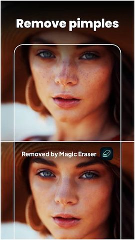 Screenshot 2: Magic Eraser - Remove Object