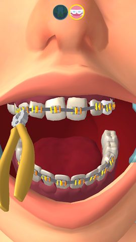Screenshot 3: Perfect Smile 3D