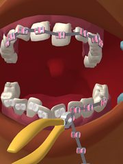 Screenshot 12: Perfect Smile 3D